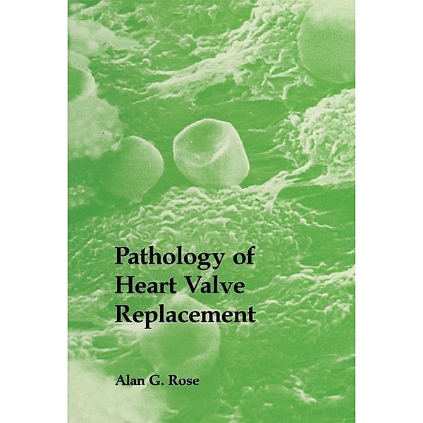 Pathology of Heart Valve Replacement, A. G. Rose
