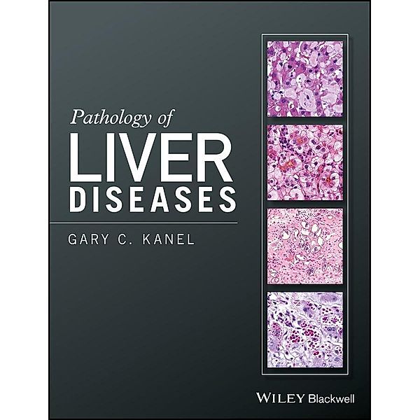 Pathology of Liver Diseases, Gary C. Kanel