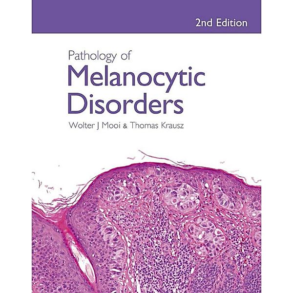Pathology of Melanocytic Disorders 2ed, Walter Mooi, Thomas Krausz