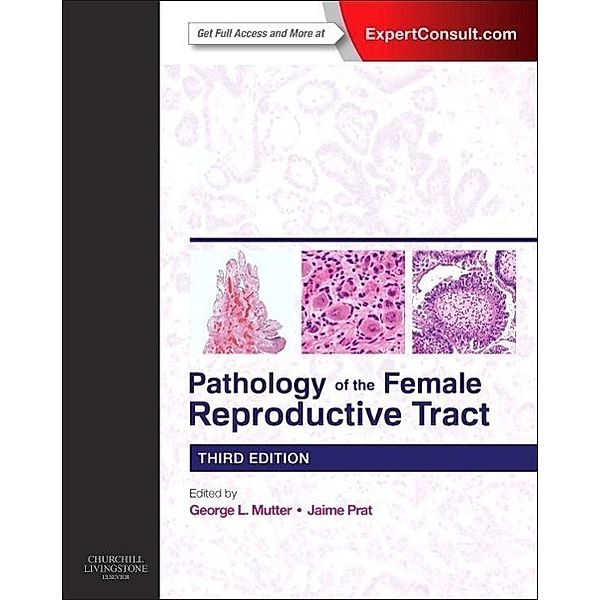 Pathology of the Female Reproductive Tract, George L. Mutter, Jaime Prat