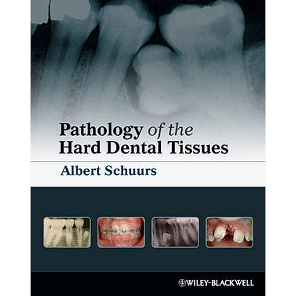 Pathology of the Hard Dental Tissues, Albert Schuurs