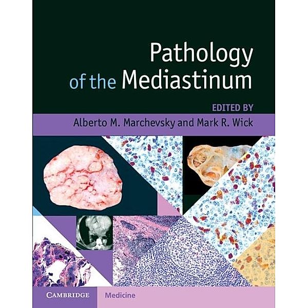 Pathology of the Mediastinum