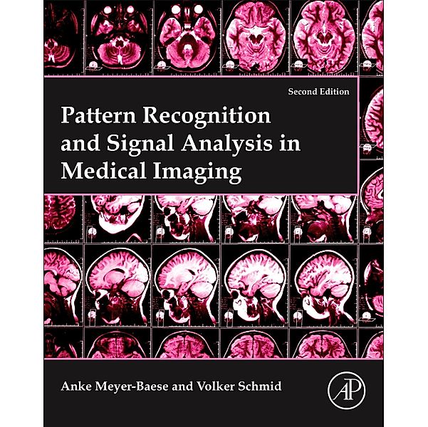 Pattern Recognition and Signal Analysis in Medical Imaging, Anke Meyer-Baese, Volker J. Schmid