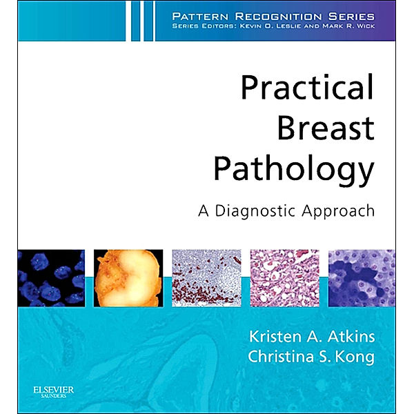 Pattern Recognition: Practical Breast Pathology: A Diagnostic Approach E-Book, Christina Kong, Kristen A. Atkins