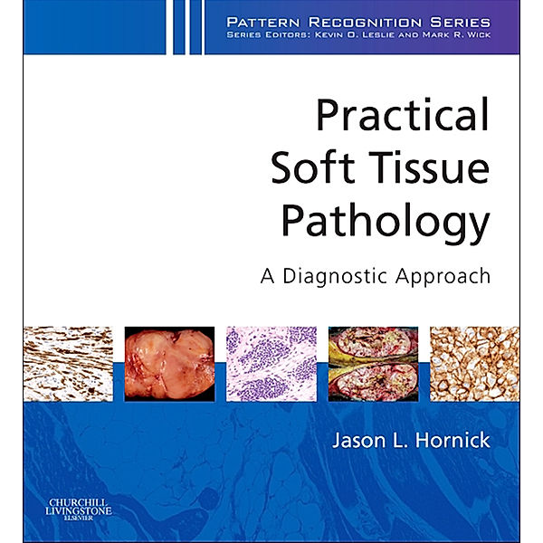 Pattern Recognition: Practical Soft Tissue Pathology: A Diagnostic Approach E-Book, Jason L. Hornick