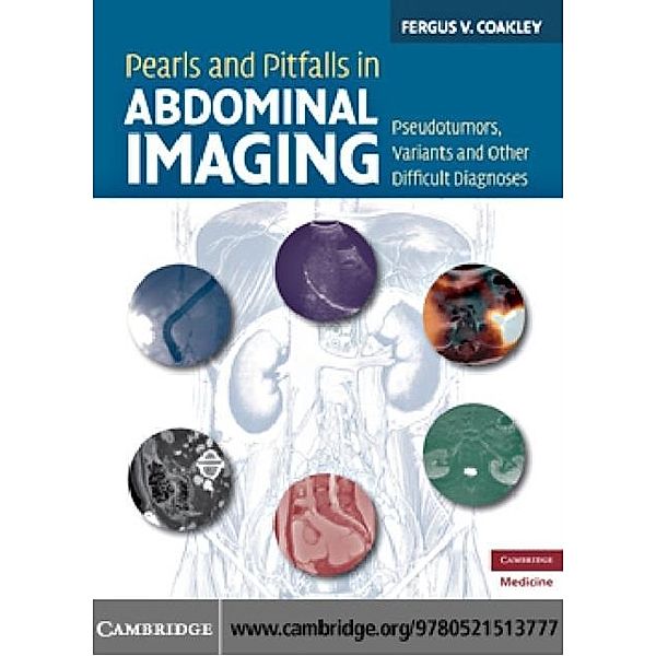 Pearls and Pitfalls in Abdominal Imaging, Fergus V. Coakley