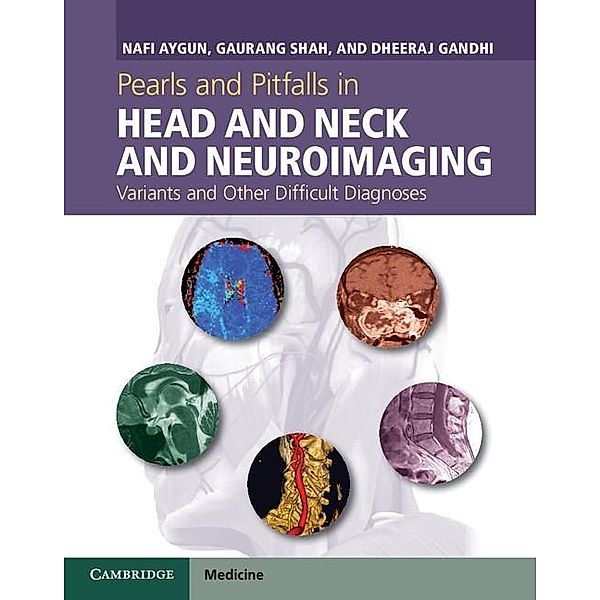 Pearls and Pitfalls in Head and Neck and Neuroimaging, Nafi Aygun
