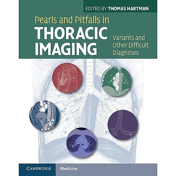 Pearls and Pitfalls in Thoracic Imaging