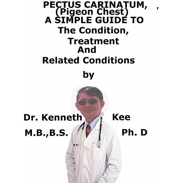 Pectus Carinatum, (Pigeon Chest) A Simple Guide To The Condition, Treatment And Related Conditions, Kenneth Kee