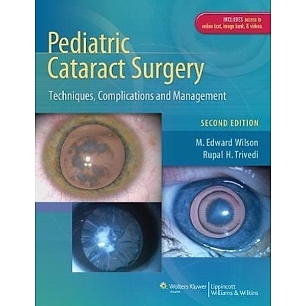 Pediatric Cataract Surgery, M Edward Wilson