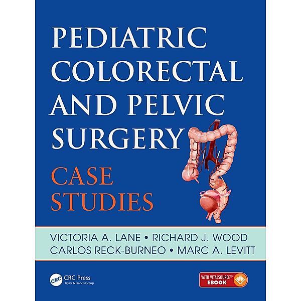 Pediatric Colorectal and Pelvic Surgery, Victoria A. Lane, Richard J. Wood, Carlos Reck