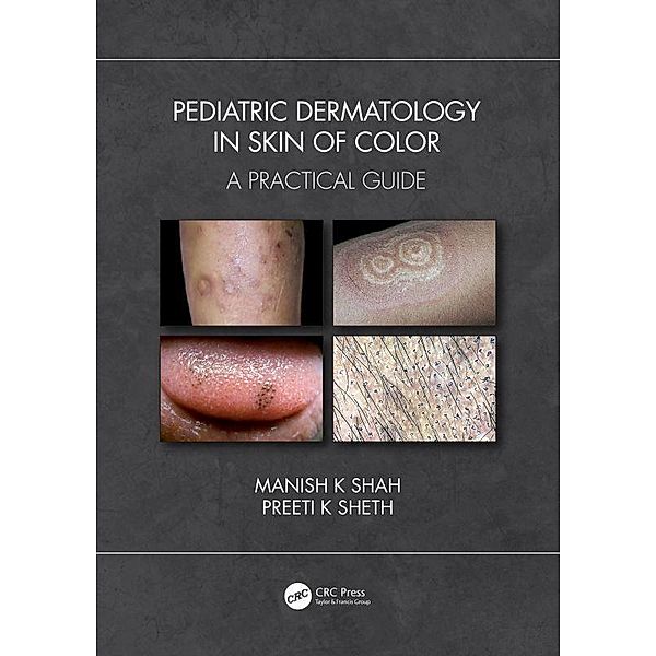Pediatric Dermatology in Skin of Color, Manish K Shah, Preeti K Sheth
