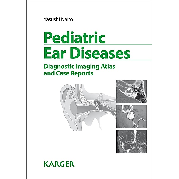 Pediatric Ear Diseases, Y. Naito