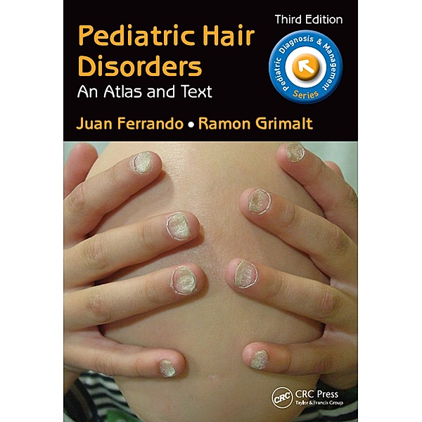 Pediatric Hair Disorders, Juan Ferrando, Ramon Grimalt