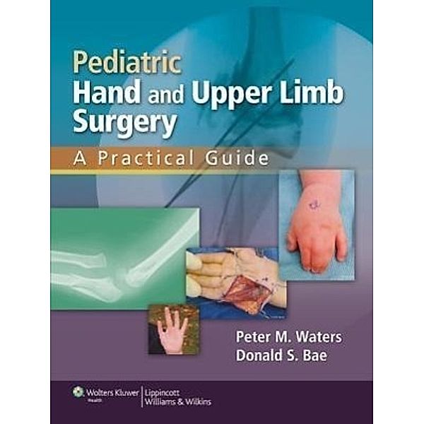 Pediatric Hand and Upper Limb Surgery: A Practical Guide, Peter M. Waters, Donald S. Bae