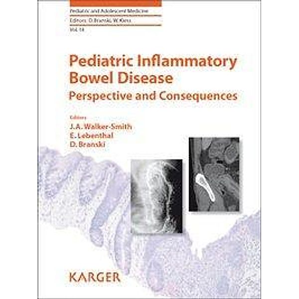 Pediatric Inflammatory Bowel Disease