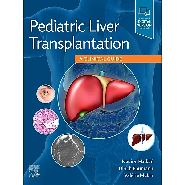 Pediatric Liver Transplantation, Nedim Hadzic, Ulrich Baumann, Valérie Mclin