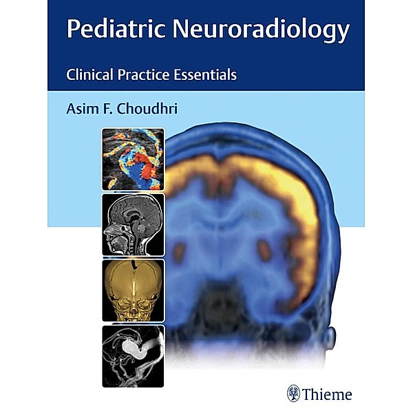 Pediatric Neuroradiology, Asim F. Choudhri