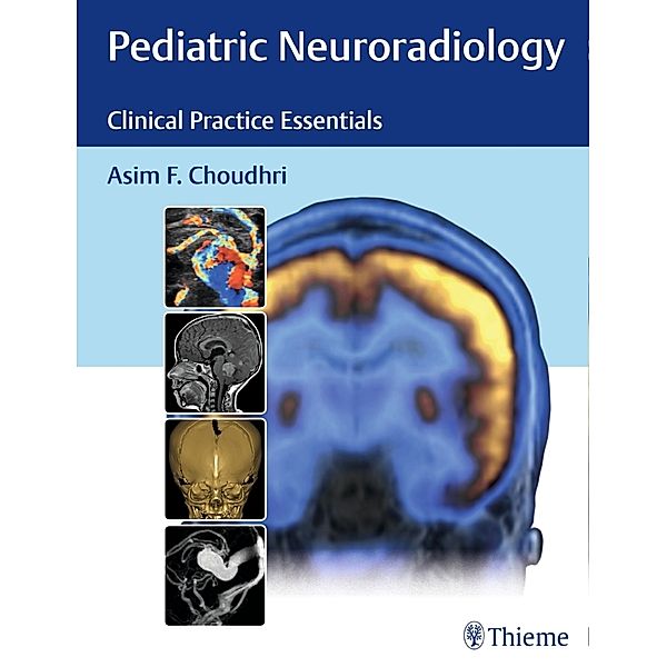 Pediatric Neuroradiology, Asim F. Choudhri