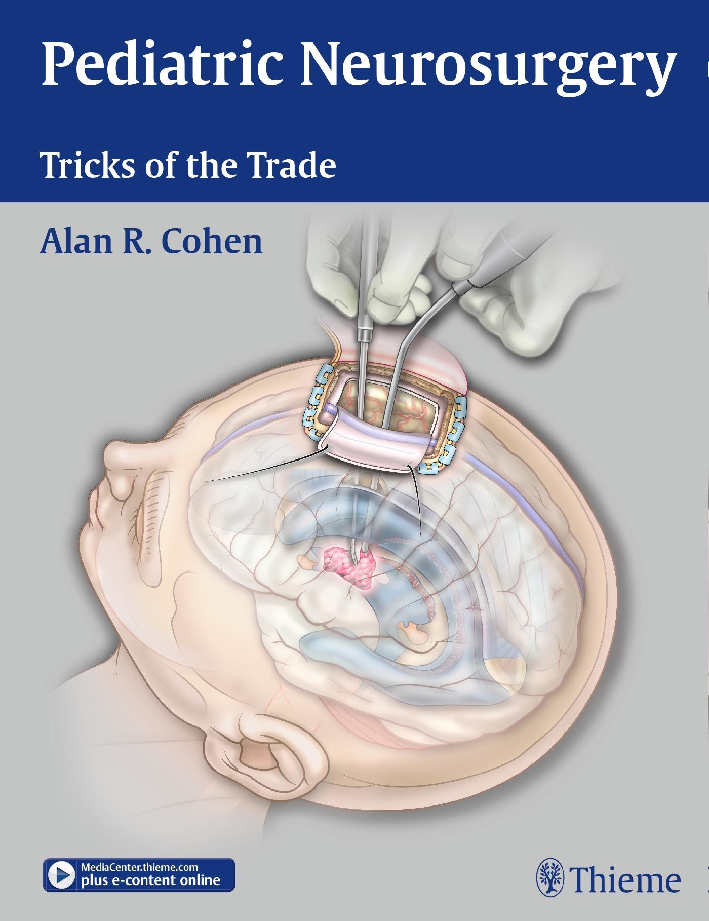 Pediatric　Neurosurgery:　the　Buch　Tricks　versandkostenfrei　of　Trade