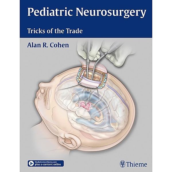 Pediatric Neurosurgery: Tricks of the Trade, Alan R. Cohen