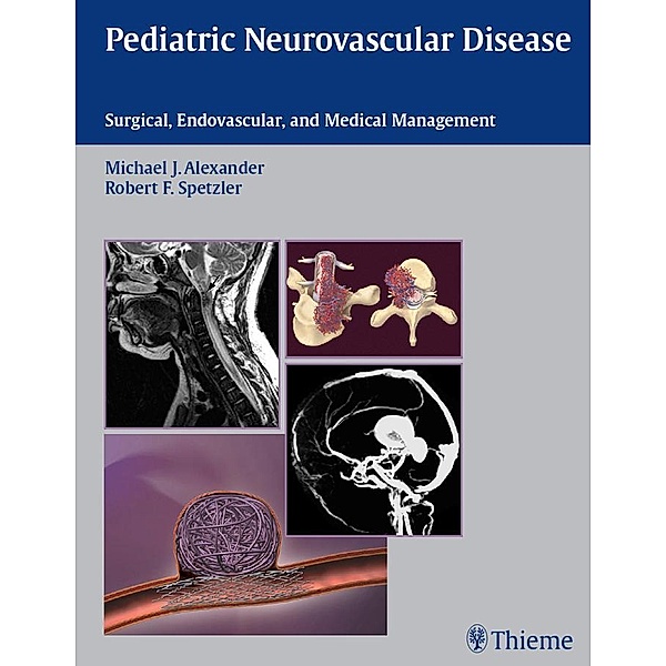 Pediatric Neurovascular Disease