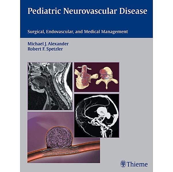 Pediatric Neurovascular Disease, Michael J. Alexander, Robert F. Spetzler