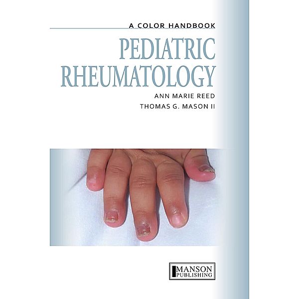 Pediatric Rheumatology, Anne Marie Reed, Thomas Mason