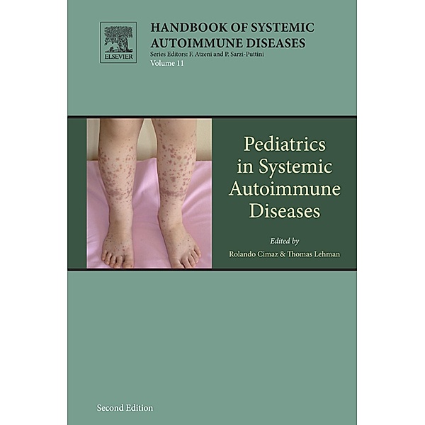 Pediatrics in Systemic Autoimmune Diseases