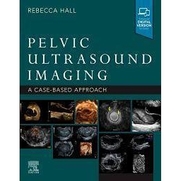 Pelvic Ultrasound Imaging: A Cased-Based Approach, Rebecca Hall