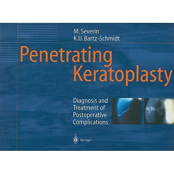 Penetrating Keratoplasty, Maria Severin, Karl-Ulrich Bartz-Schmidt