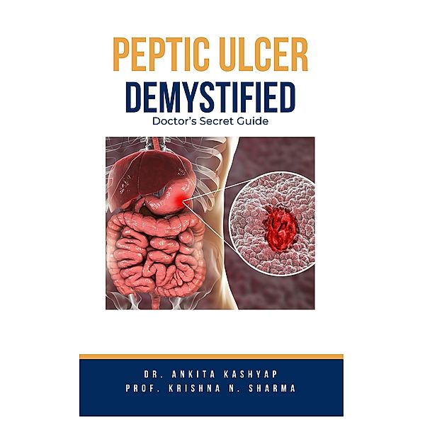 Peptic Ulcer Demystified: Doctor's Secret Guide, Ankita Kashyap, Krishna N. Sharma