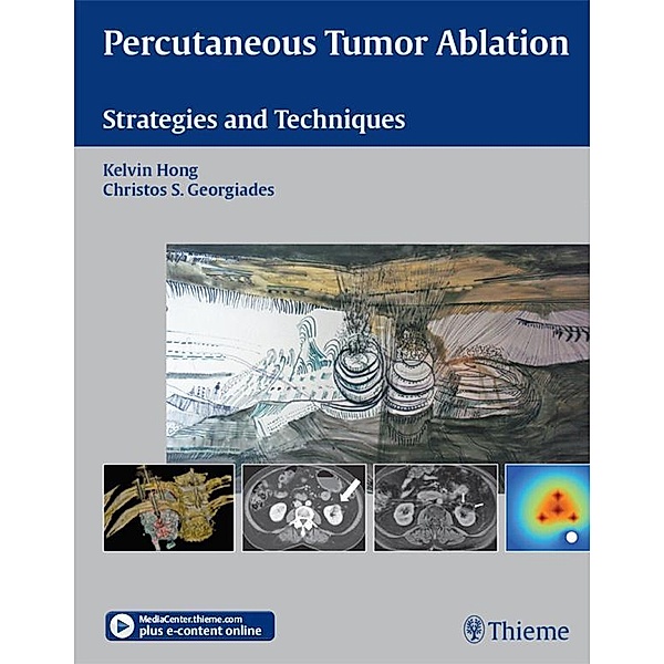 Percutaneous Tumor Ablation