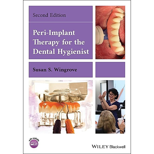 Peri-Implant Therapy for the Dental Hygienist, Susan S. Wingrove