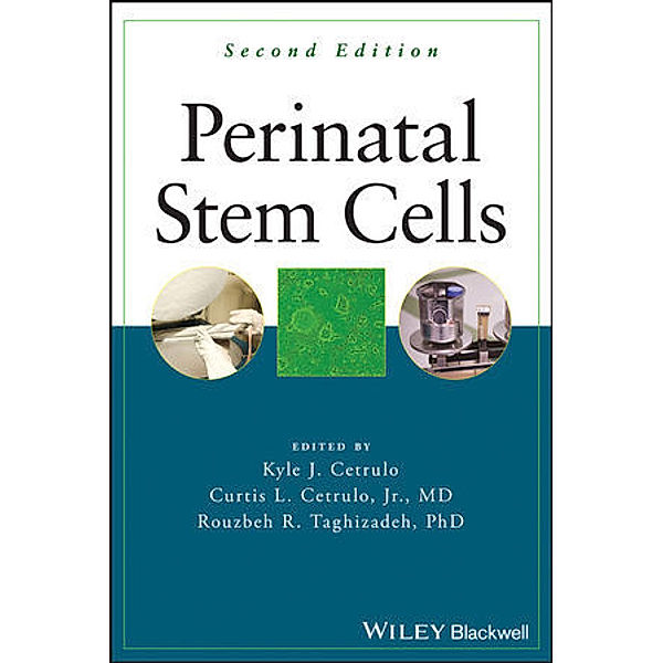 Perinatal Stem Cells