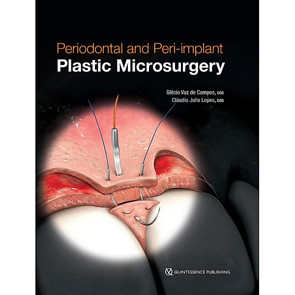 Periodontal and Peri-implant Plastic Microsurgery, Glécio Vaz de Campos, Cláudio Julio Lopes