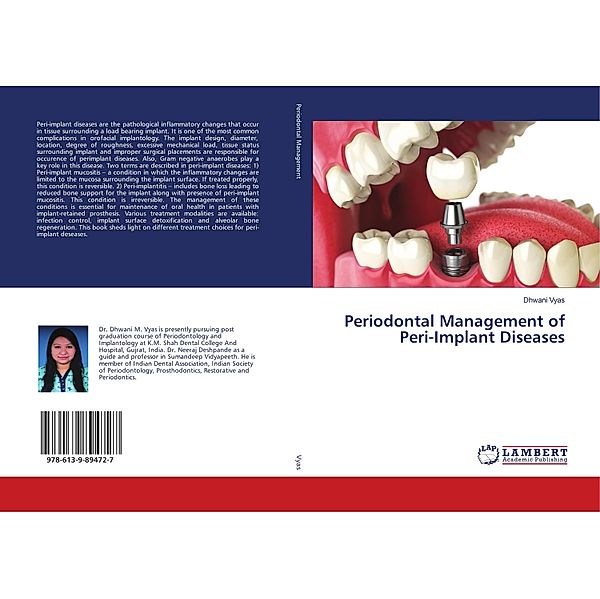 Periodontal Management of Peri-Implant Diseases, Dhwani Vyas
