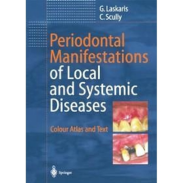 Periodontal Manifestations of Local and Systemic Diseases, George Laskaris, Crispian Scully