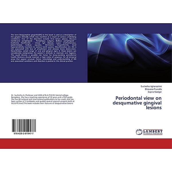 Periodontal view on desqumative gingival lesions, Suchetha Aghanashini, Bhavana Puvvalla, Sapna Nadiger
