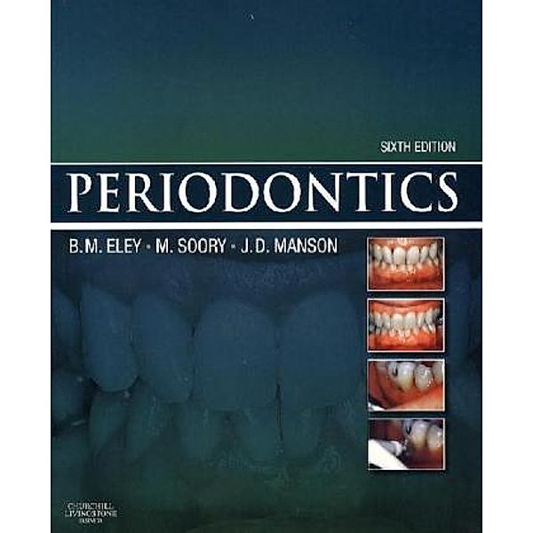 Periodontics, Barry Eley, David Manson