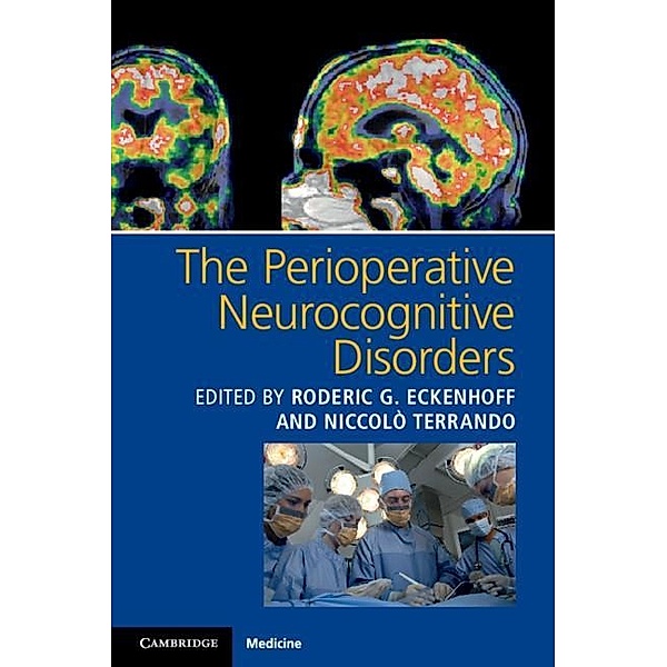 Perioperative Neurocognitive Disorders