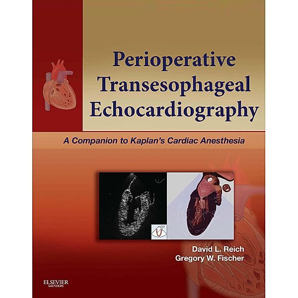 Perioperative Transesophageal Echocardiography E-Book, David L. Reich, Gregory Fischer