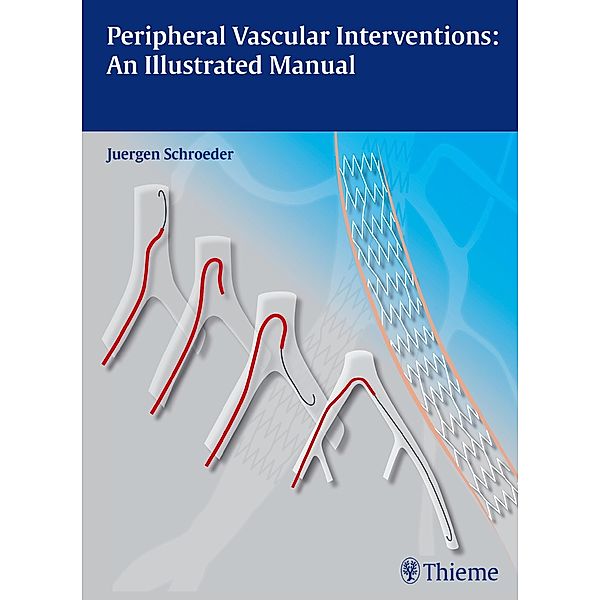Peripheral Vascular Interventions: An Illustrated Manual, Jürgen Schröder