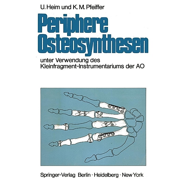 Periphere Osteosynthesen, Urs Heim, Karl M. Pfeiffer