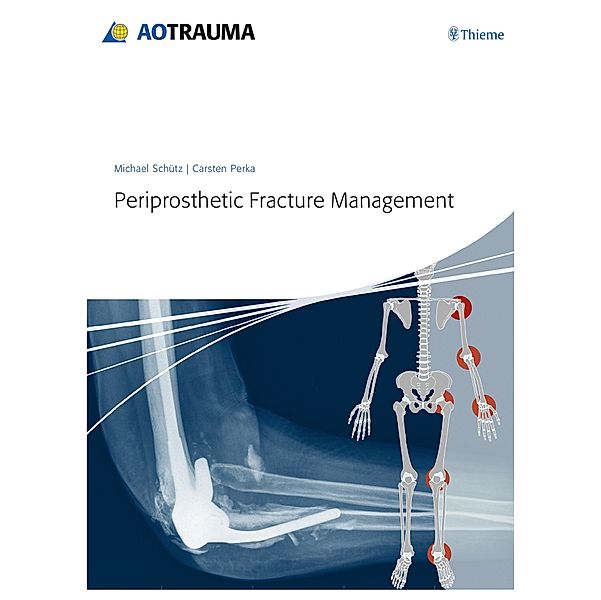 Periprosthetic Fracture Management, Michael Schütz, Carsten Perka