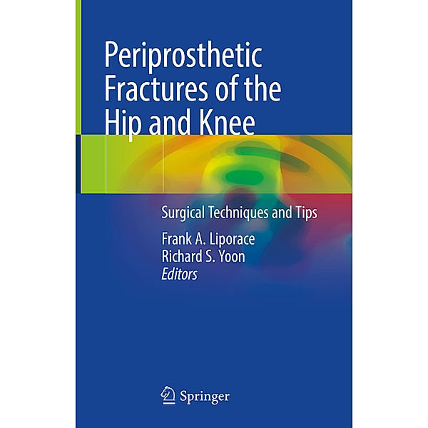 Periprosthetic Fractures of the Hip and Knee