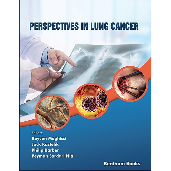 Perspectives in Lung Cancer / Frontiers in Lung Cancer Bd.1