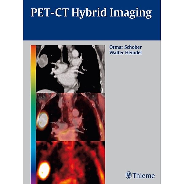 PET-CT Hybrid Imaging, Otmar Schober, Walter Heindel