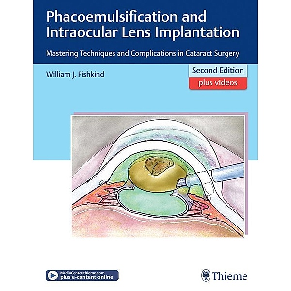 Phacoemulsification and Intraocular Lens Implantation, William J. Fishkind
