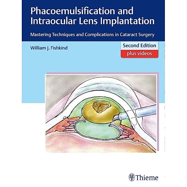 Phacoemulsification and Intraocular Lens Implantation, William J. Fishkind